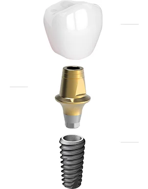 ส่วนประกอบรากฟันเทียม ครอบฟัน ส่วนเชื่อมต่อ และตัวรากเทียม (ภาพจาก Dentis)