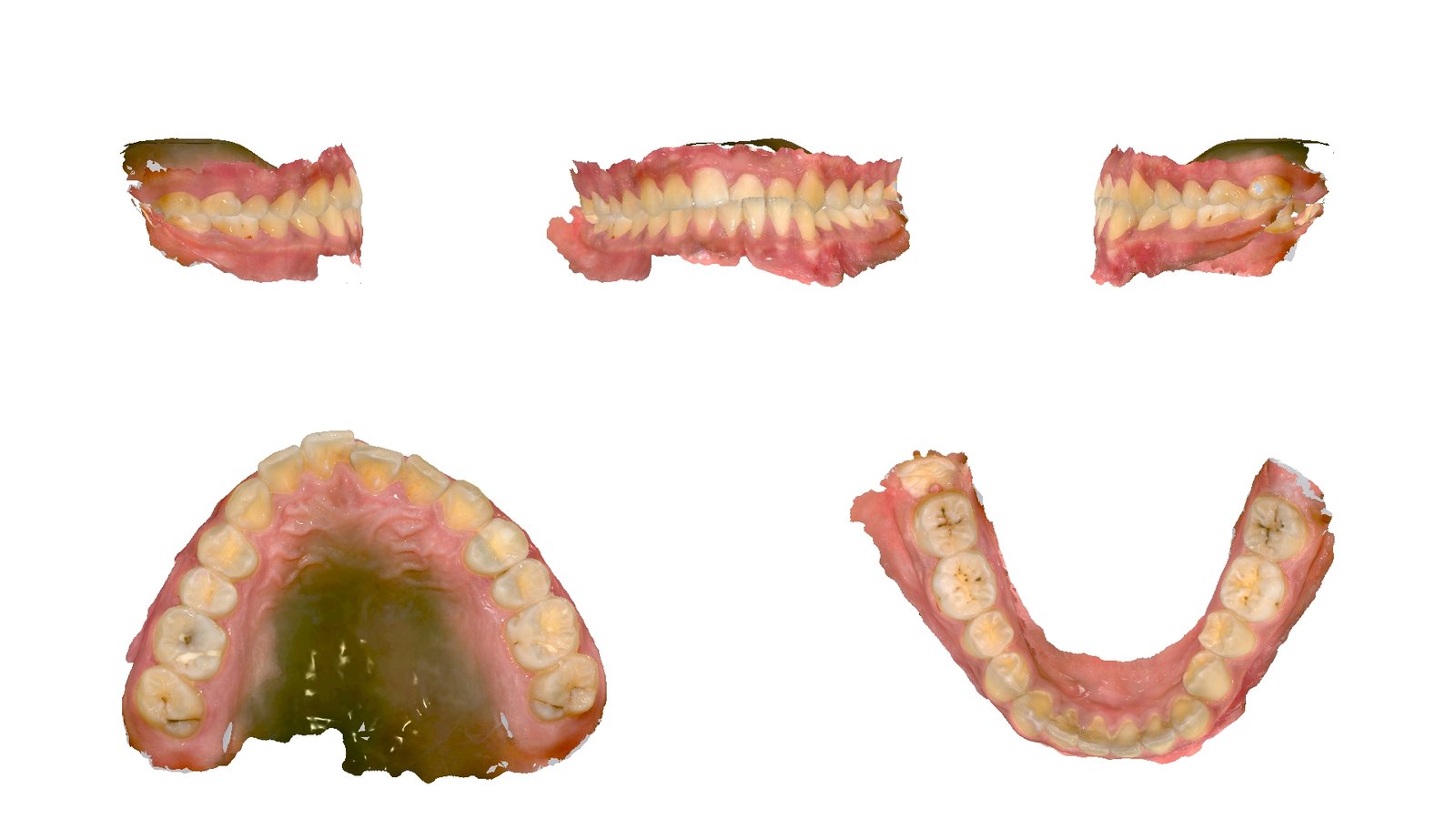 ภาพข้อมูลสแกนฟัน 3D จากคลินิก Tooth Matter