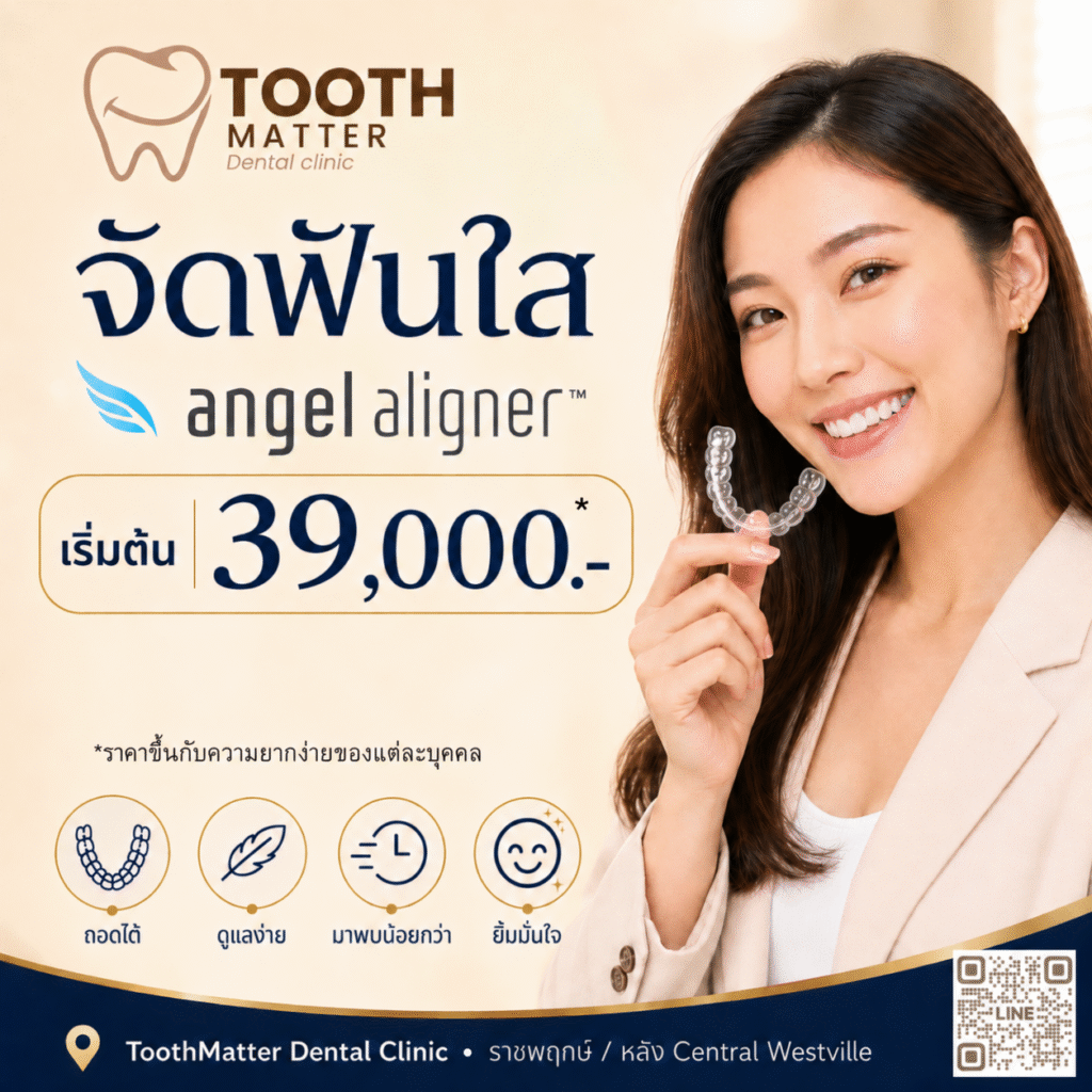 จัดฟันใส Angel Aligner เริ่มต้น 39,000 บาท ที่ Tooth Matter ราชพฤกษ์