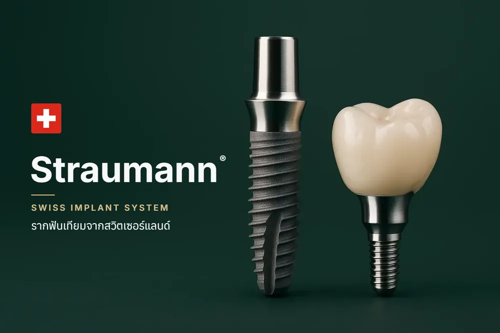 รากฟันเทียม Straumann จากสวิตเซอร์แลนด์ พร้อมครอบฟัน (ภาพประกอบ)